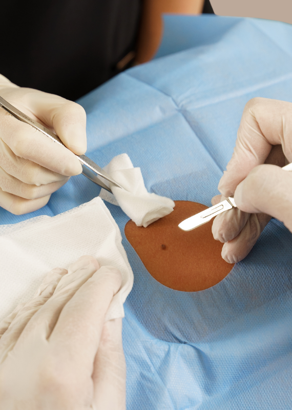 dermatologia-cirurgica
