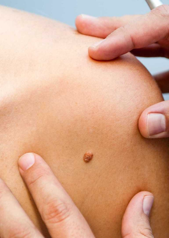 Dermatologia Cirurgica