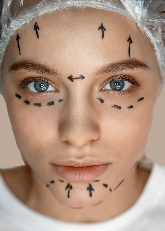 harmonização facial